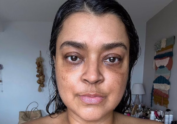 Em tratamento contra câncer, Preta Gil aparece sem filtro nas redes sociais: Sigamos na luta